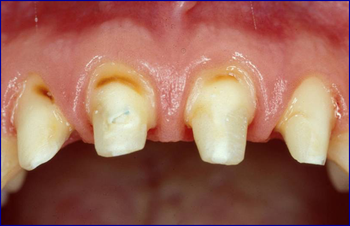 Un primo piano dei denti di una persona 