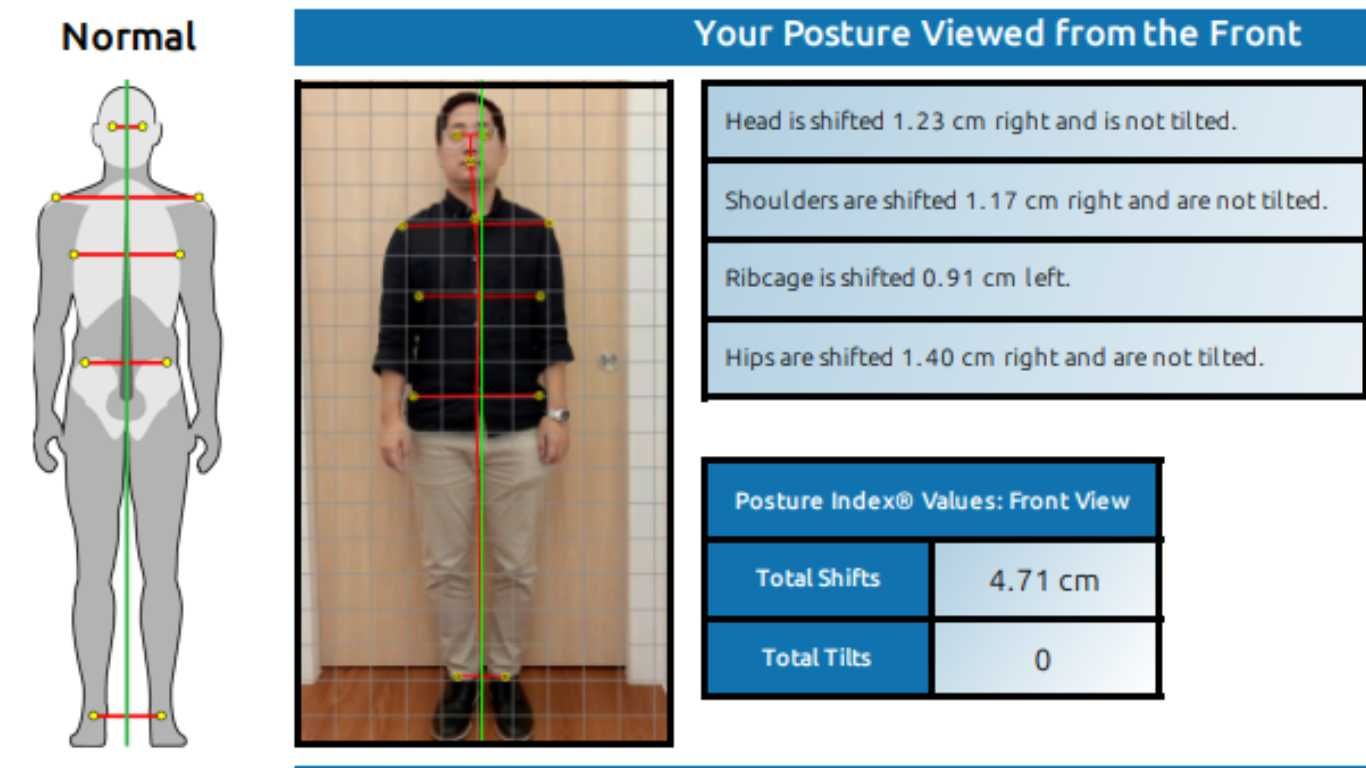 Advanced Posture Analysis Using AI Technology