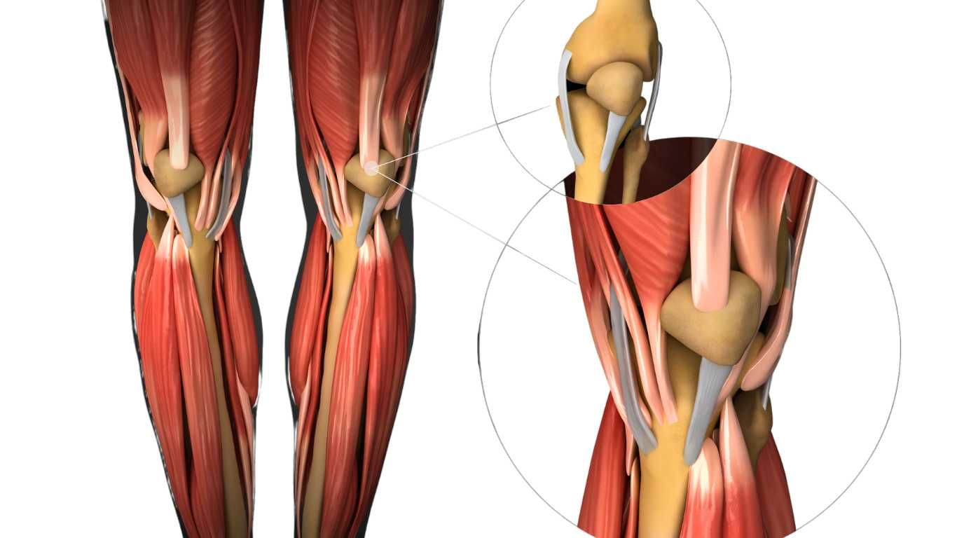 tendonitis tendonitis