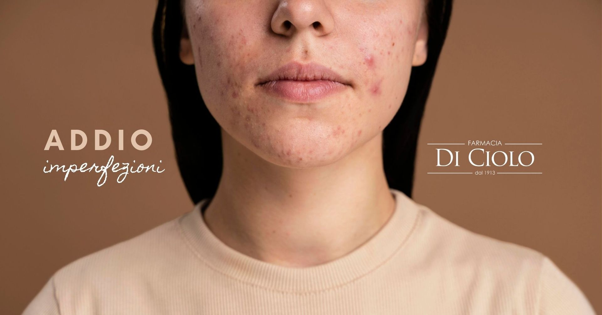 Una persona con evidenti imperfezioni cutanee sul viso, su sfondo marrone, con le scritte