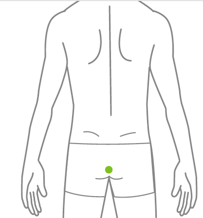 Ilustração técnica indicando a região perianal para tratamento de depilação a laser masculina.
