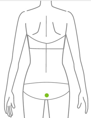 Ilustração indicando a região dos glúteos para aplicação da depilação a laser.