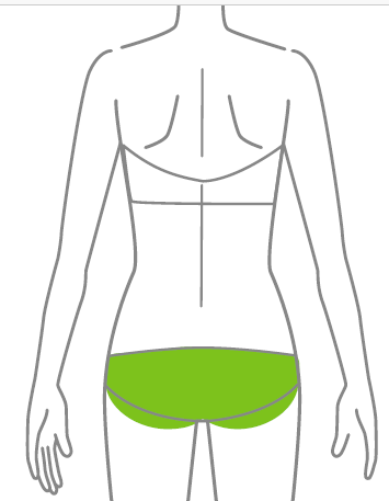 Ilustração indicando a região dos glúteos para aplicação da depilação a laser.