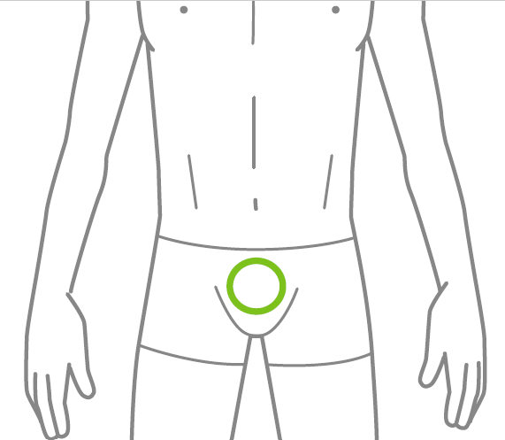 Ilustração técnica indicando a região da base do pênis para tratamento de depilação a laser masculina.
