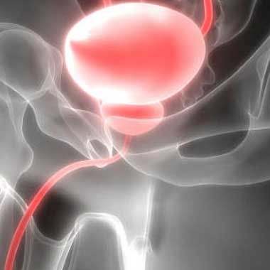 CANCER DE PROSTATA