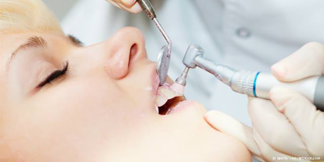 Prophylaxe für Kinder und Jugendliche, Professionelle Zahnreinigung (PZR)