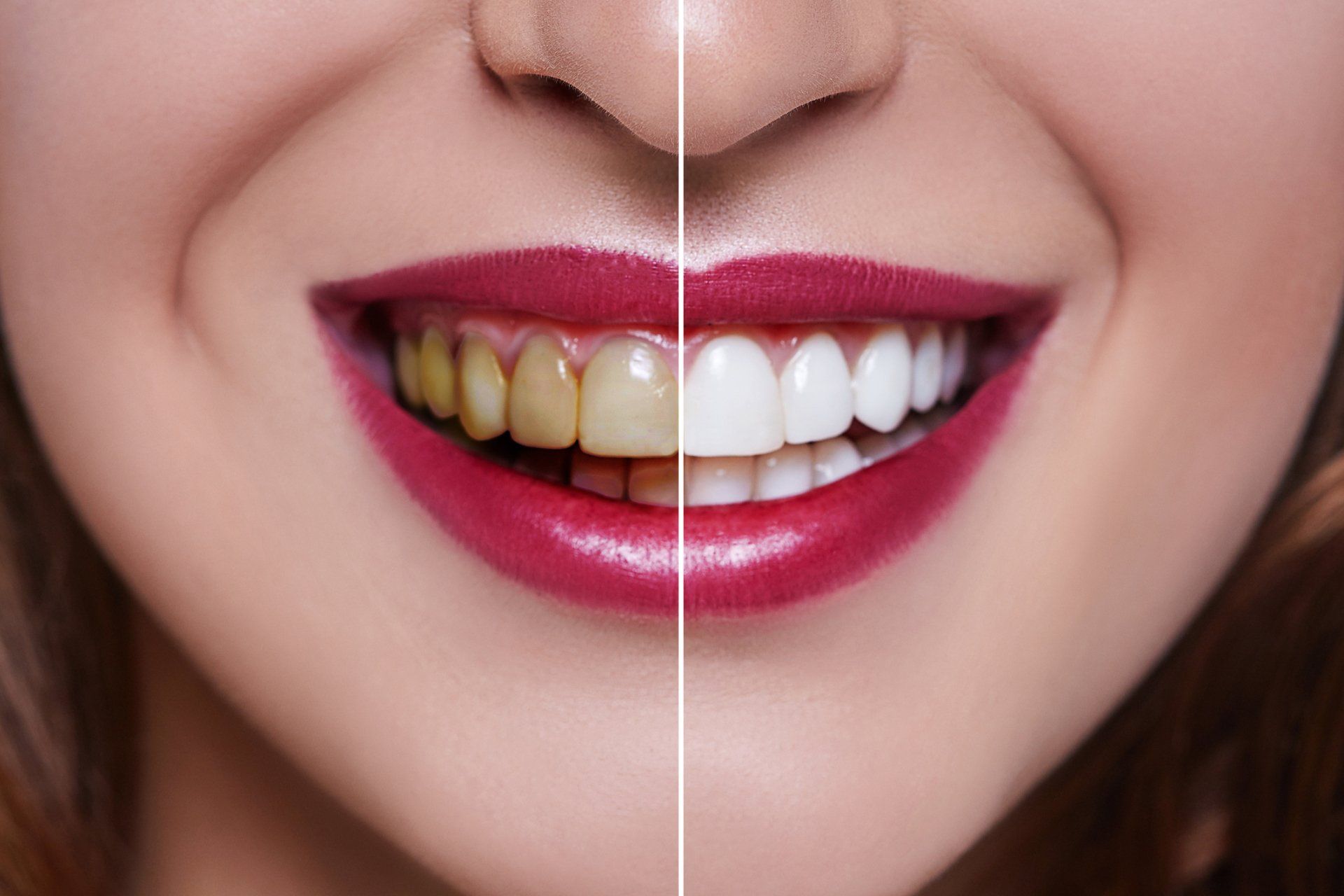 Dental Restorations — Taylor, MI — Taylor Smiles