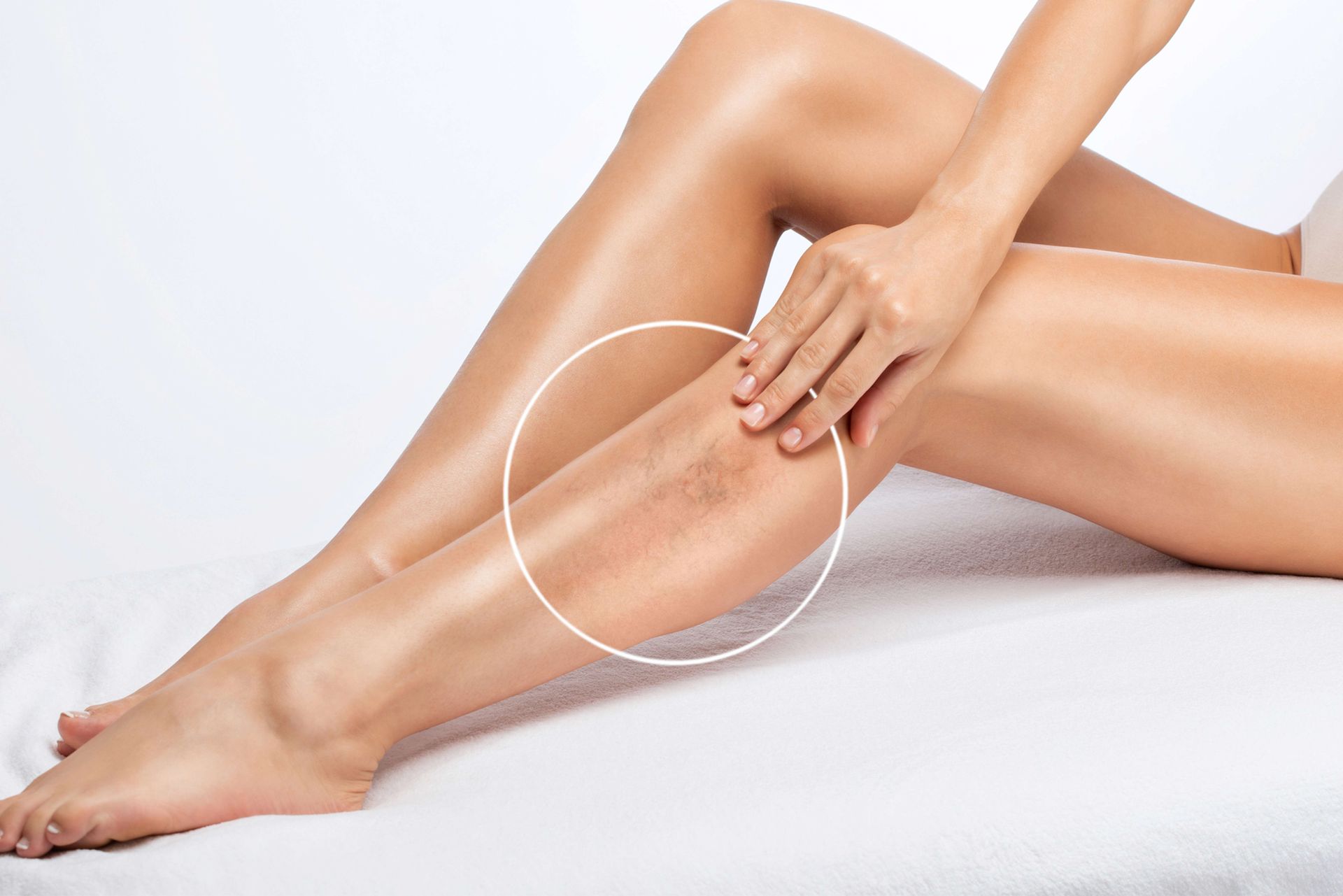 Small Blood Vessels of the Skin — Morganville, NJ — Bombshell Aesthetic Medical Spa Small Blood Vessels of the Skin — Morganville, NJ — Bombshell Aesthetic Medical Spa