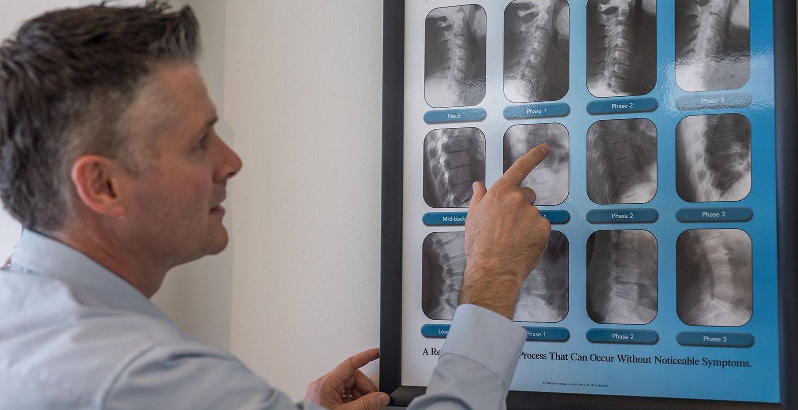 A man is pointing at an x-ray of a spine.