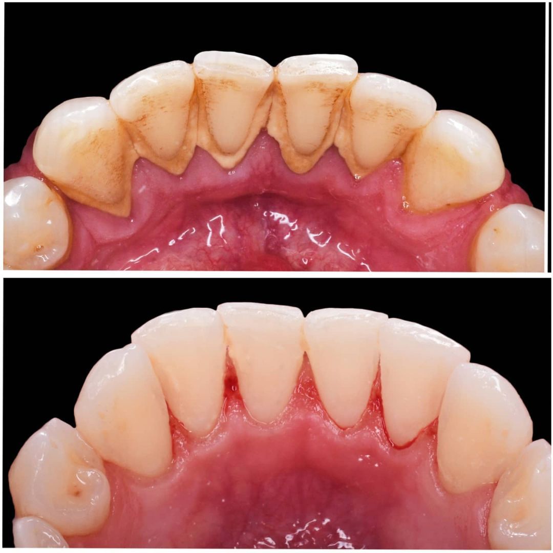 SMILE GALLERY - TLC Dental Wellness