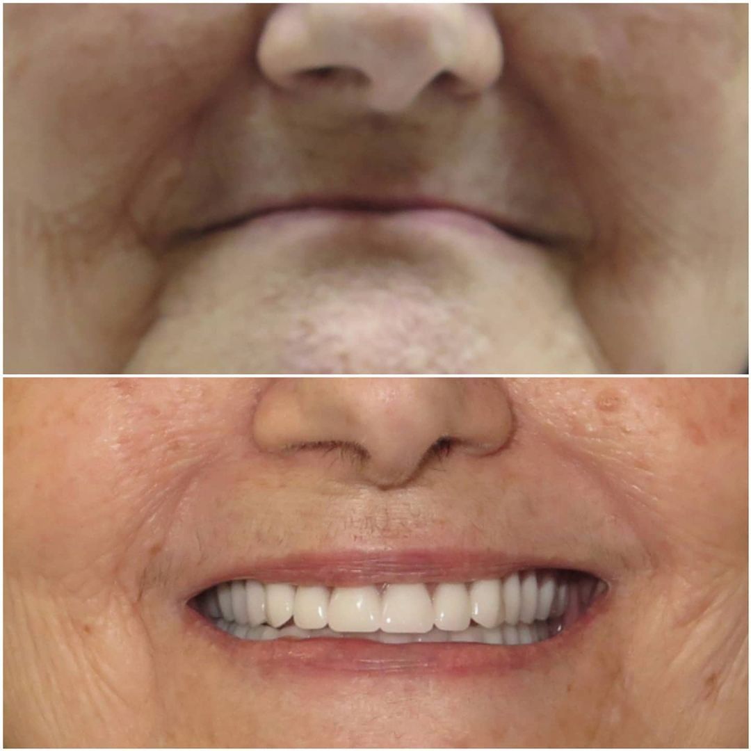 SMILE GALLERY - TLC Dental Wellness