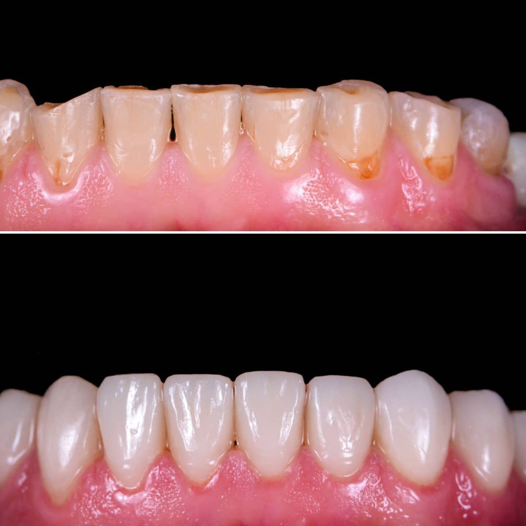 SMILE GALLERY - TLC Dental Wellness