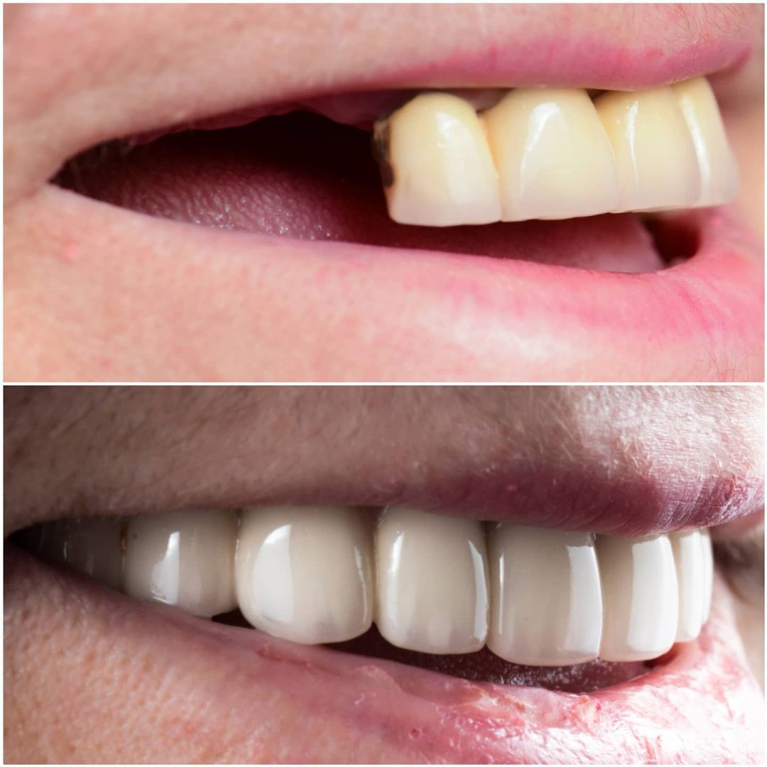 SMILE GALLERY - TLC Dental Wellness