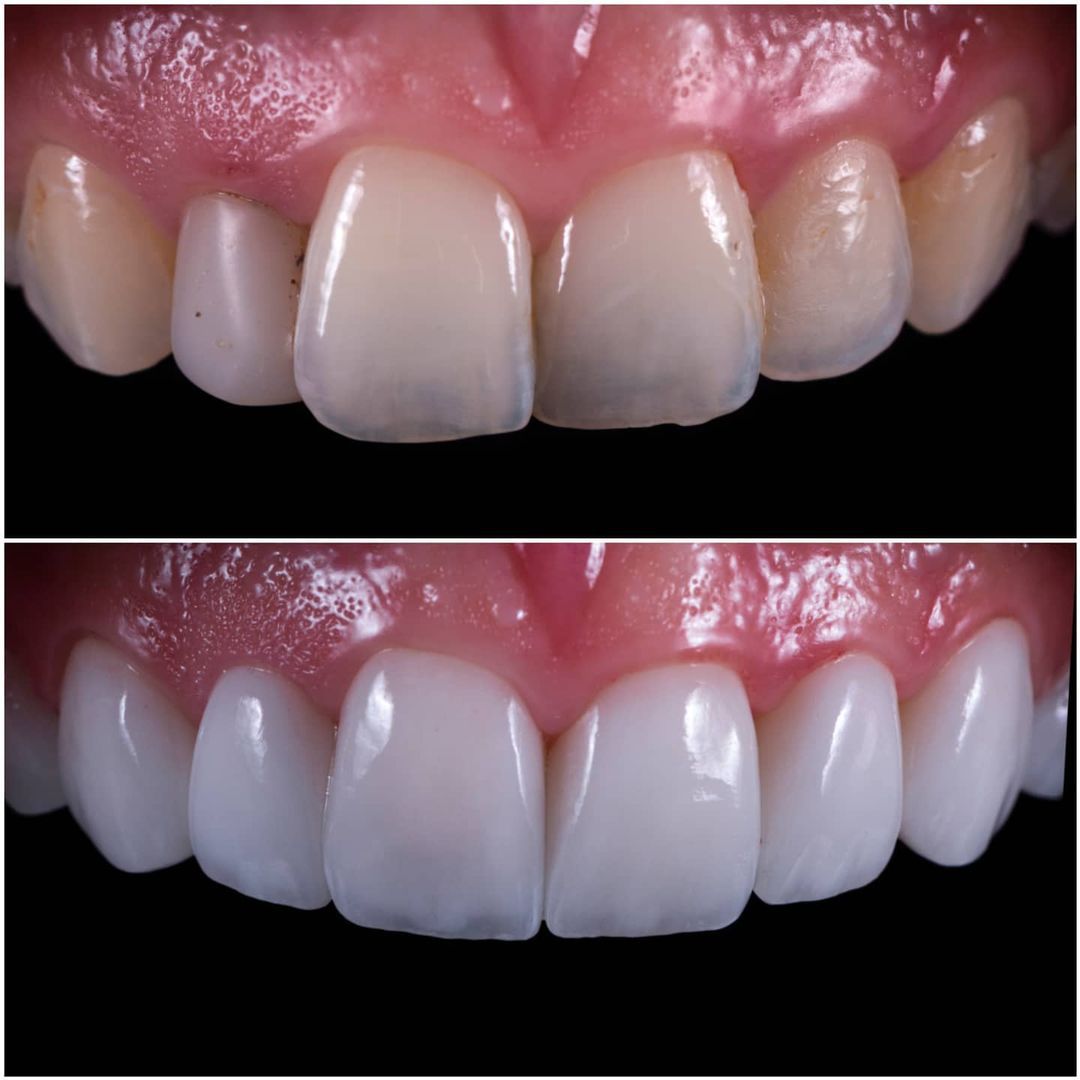 SMILE GALLERY - TLC Dental Wellness