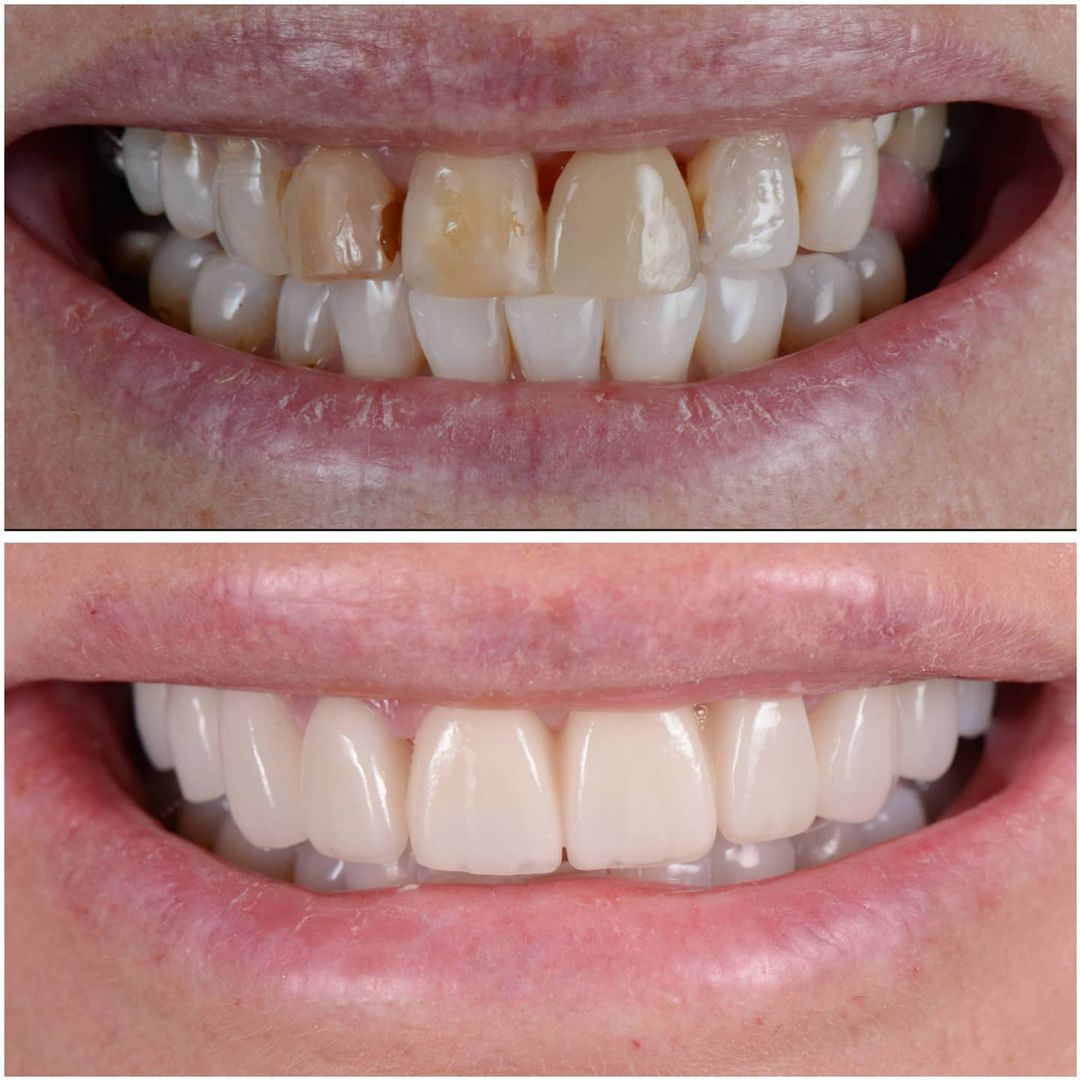 SMILE GALLERY - TLC Dental Wellness