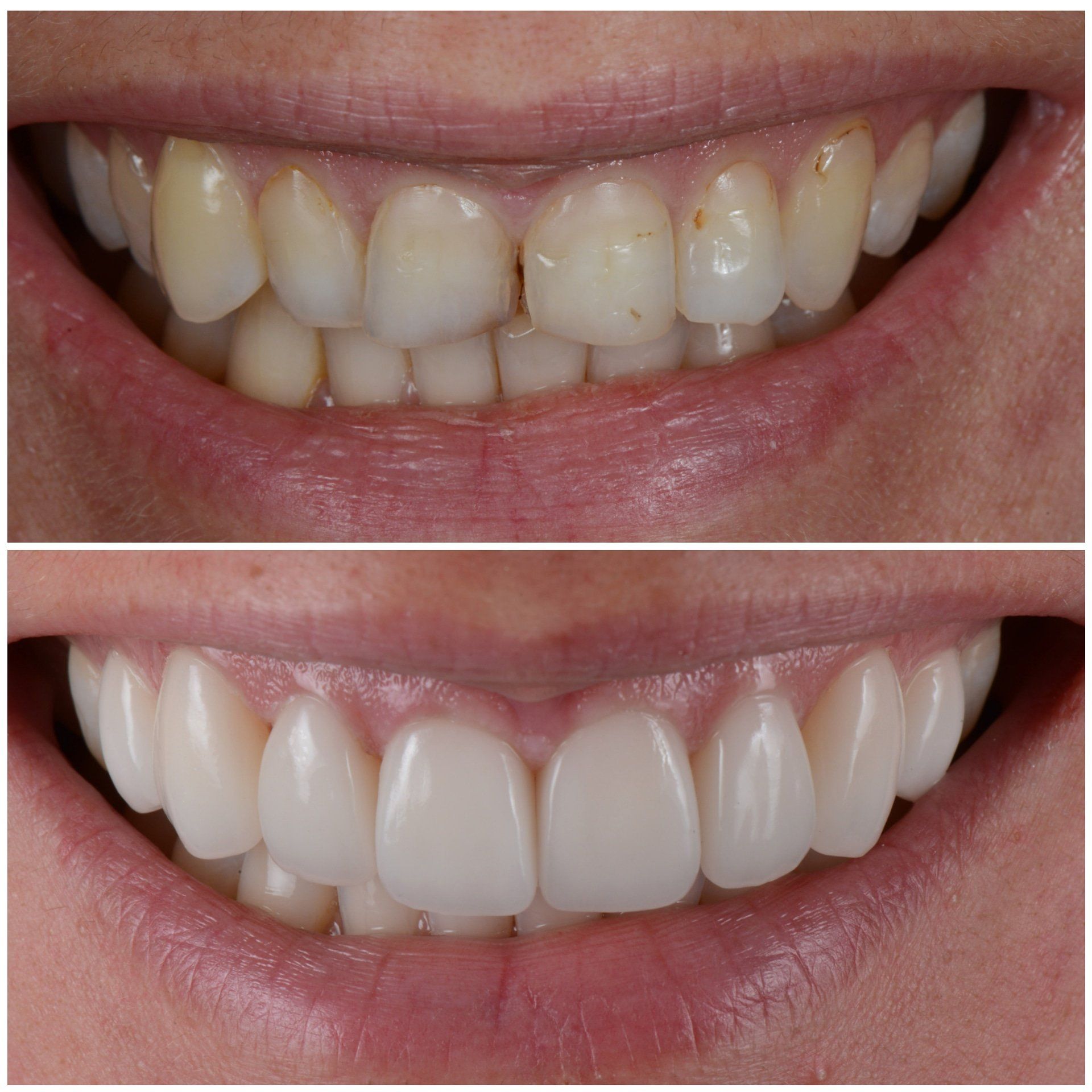 SMILE GALLERY - TLC Dental Wellness