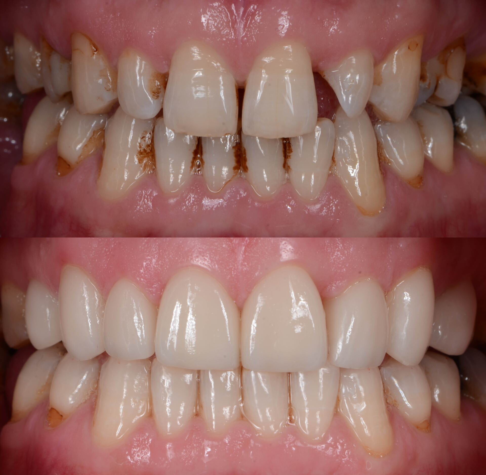 SMILE GALLERY - TLC Dental Wellness