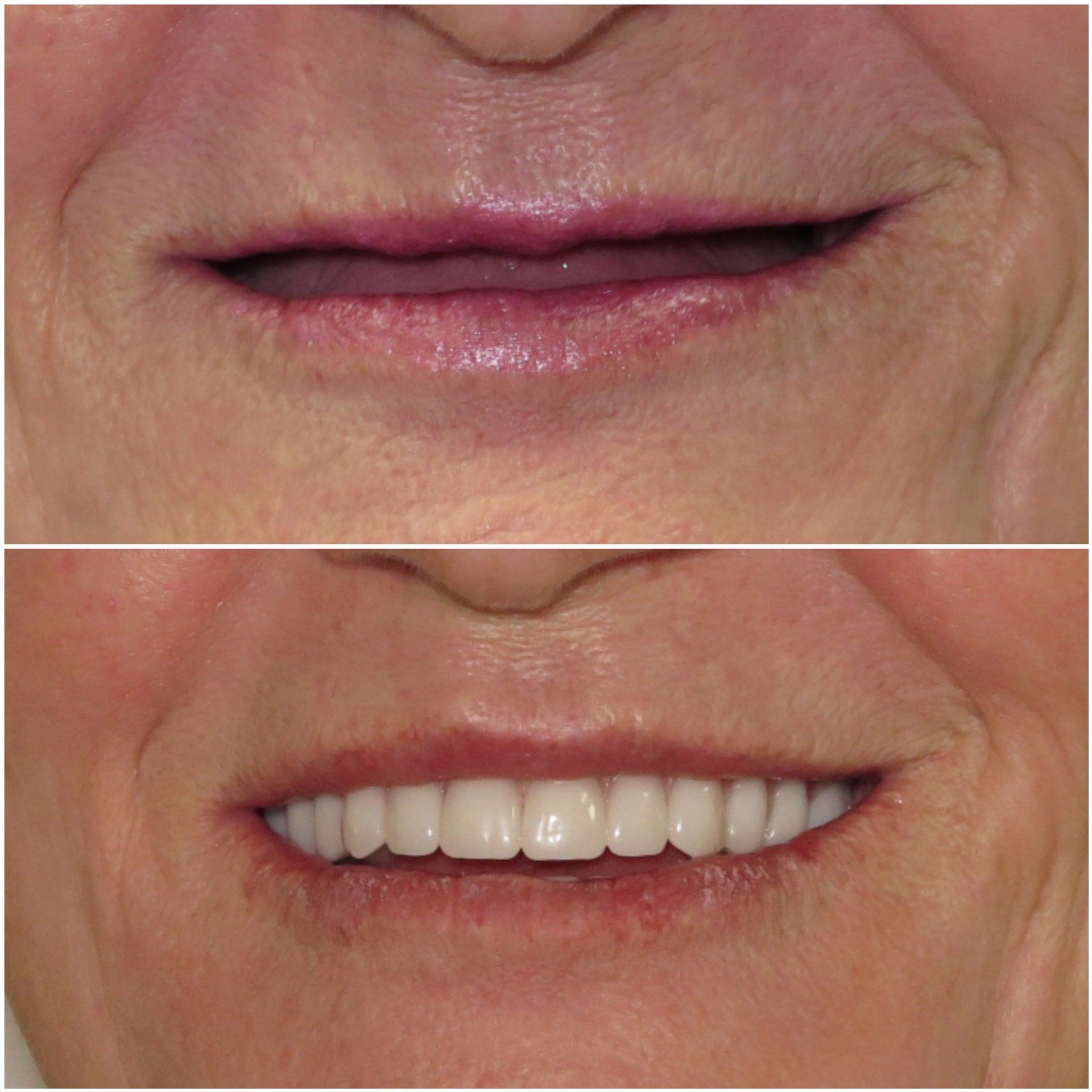 SMILE GALLERY - TLC Dental Wellness