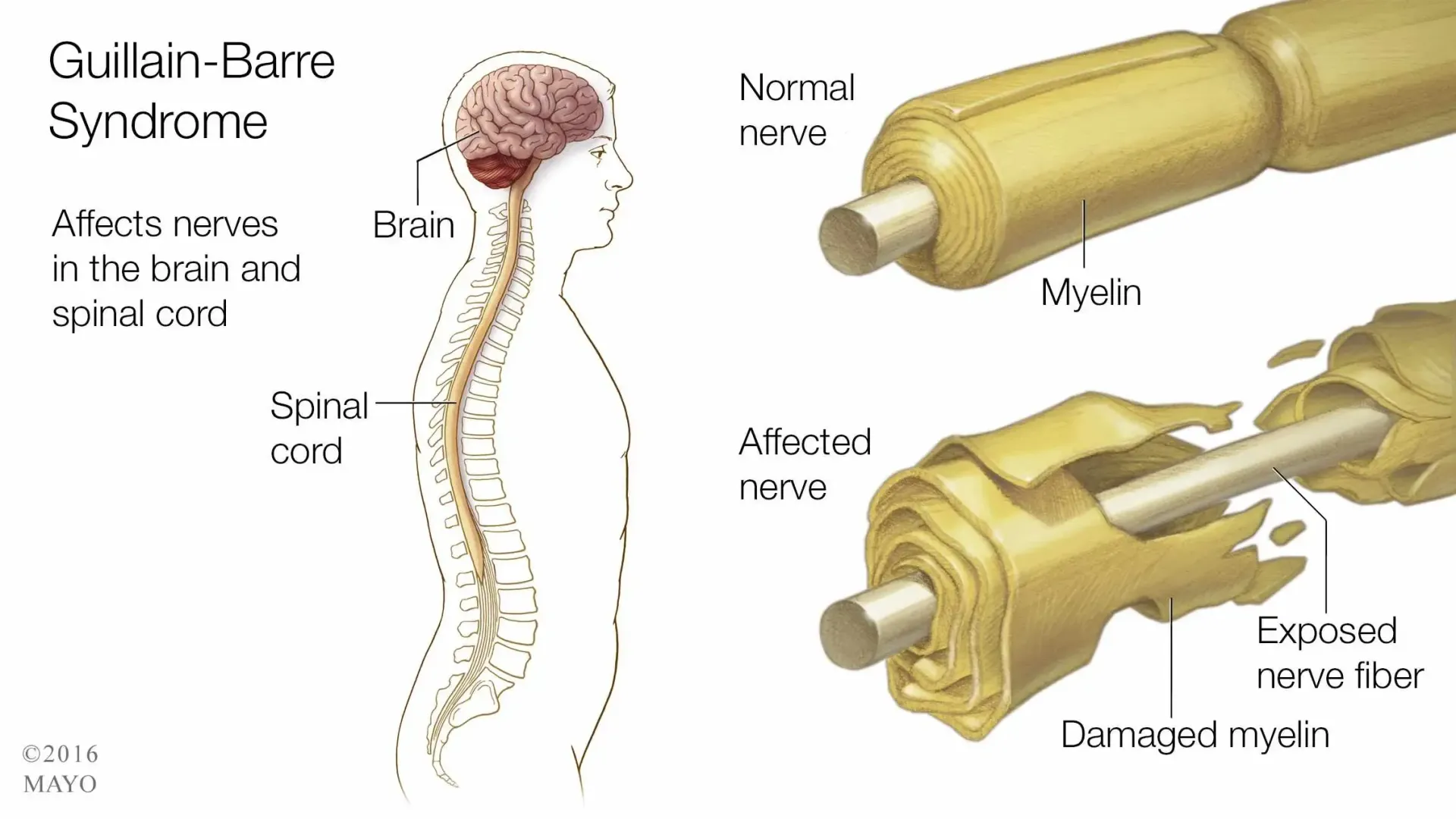 A diagram of a spinal cord and a brain.