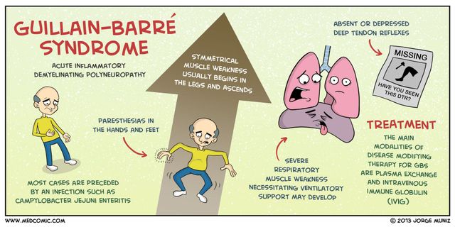 guillain barre syndrome and glutathione Guillain-Barr Guillain-Barre Syndrome (GBS) diagnosis and