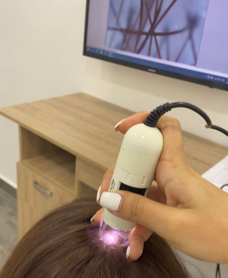 dermatoscopia en panama - tricologia 