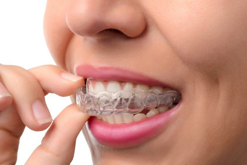 A woman is putting a clear brace on her teeth.