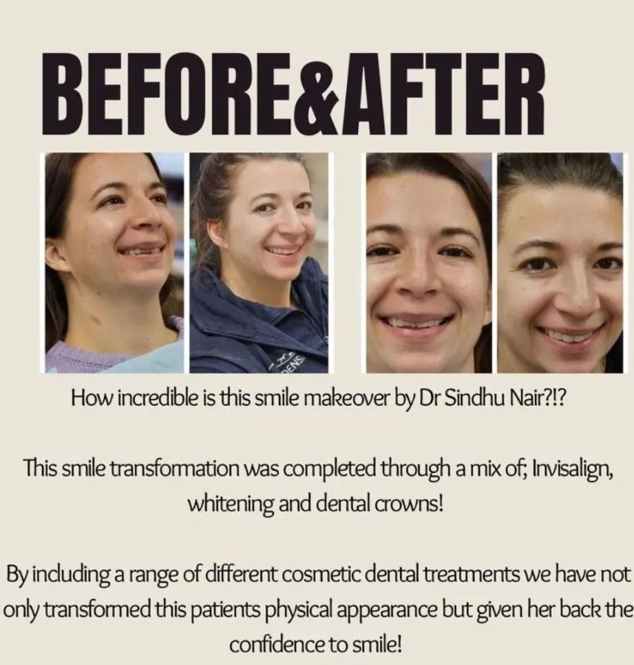 A before and after photo of a woman with braces