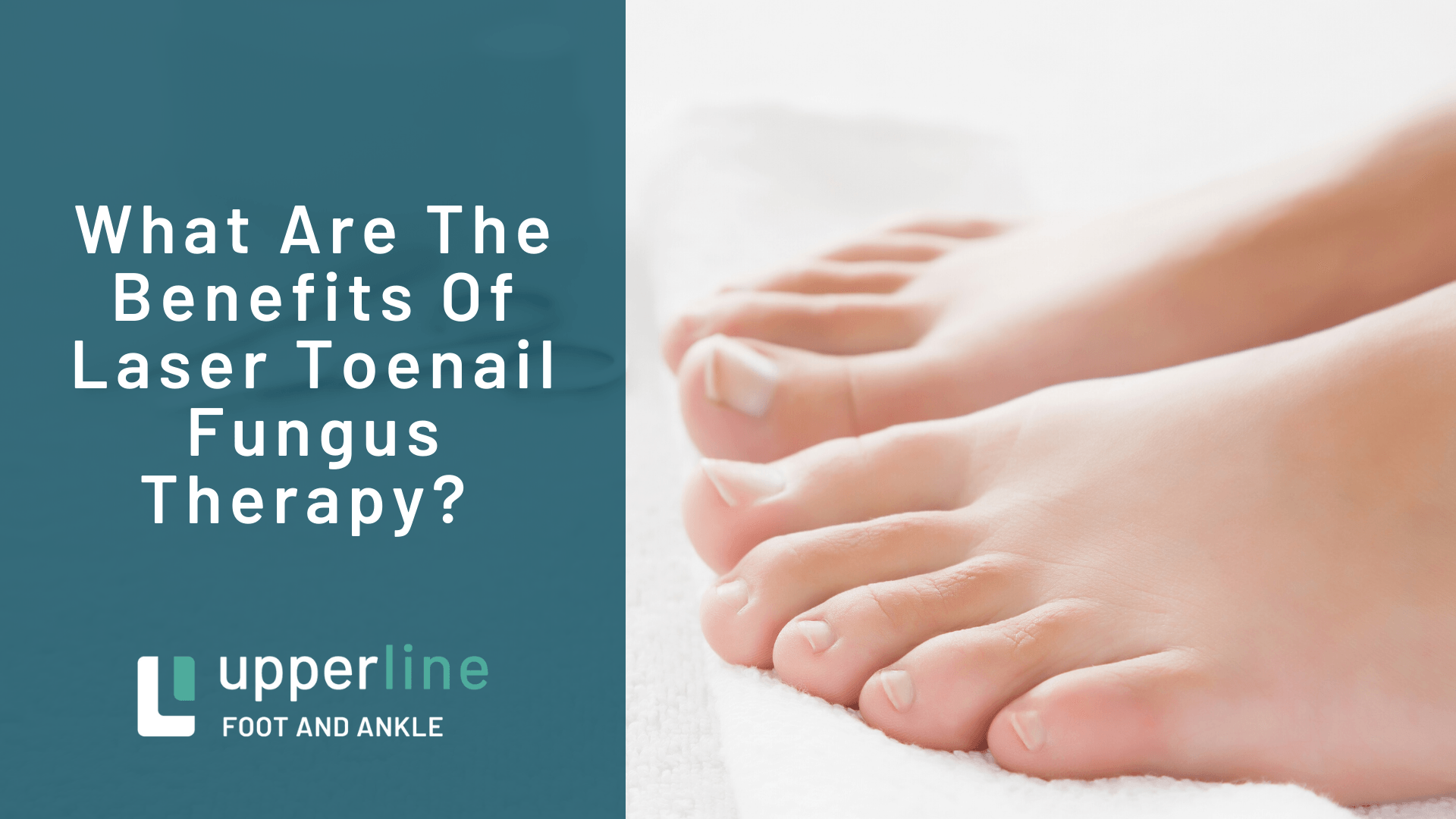What Are The Benefits Of Laser Toenail Fungus Therapy?