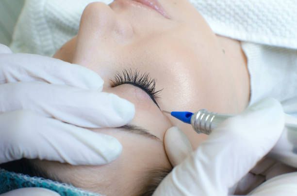 Person receiving permanent eyeliner. A technician in gloves uses a tattoo pen near the eyelid.