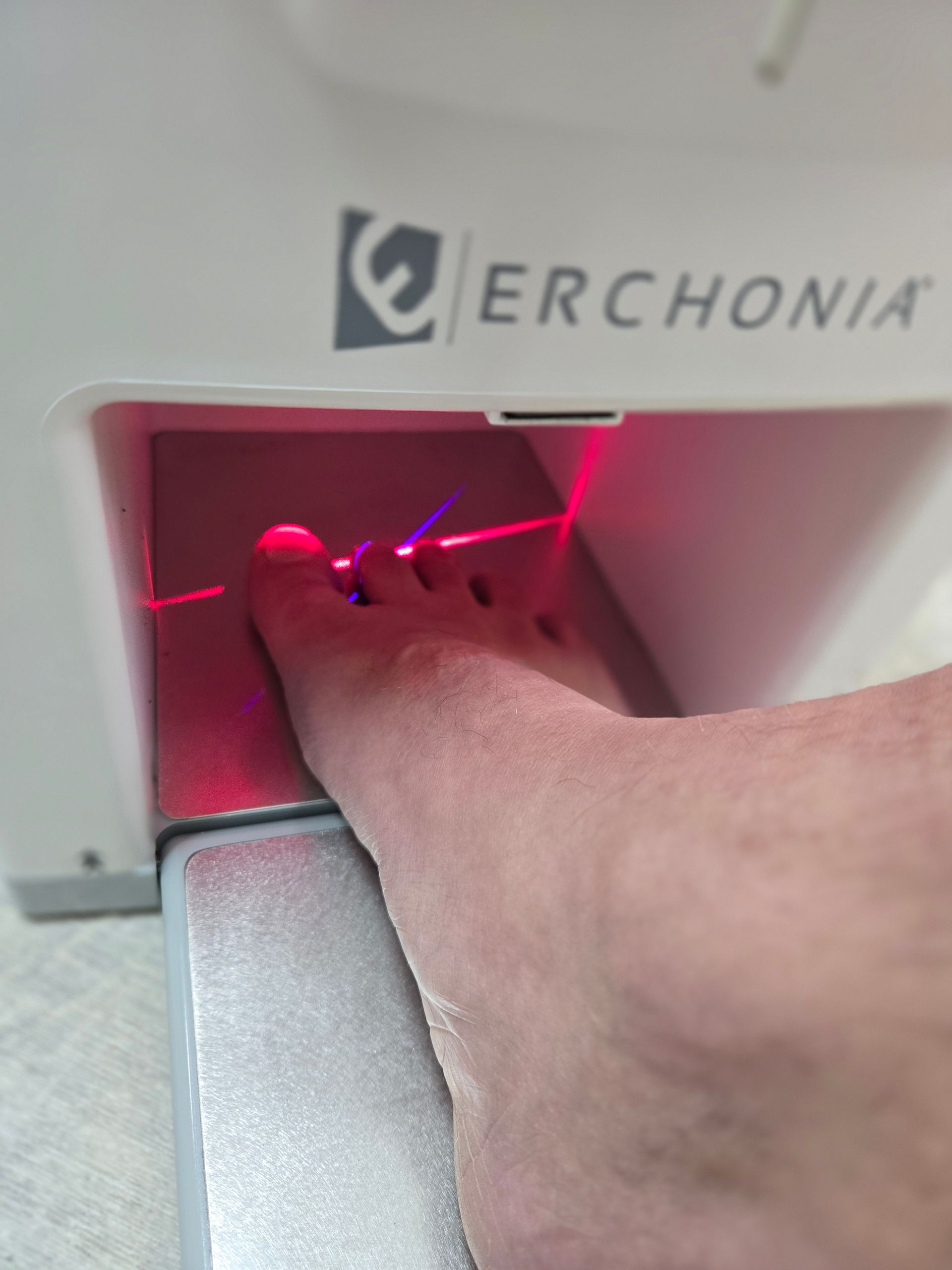 Fungal Nail treatment Dublin