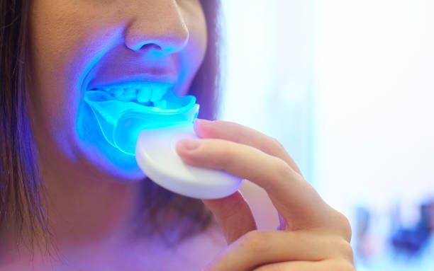 Close-up of a young woman using her teeth whitening mouthpiece at home.