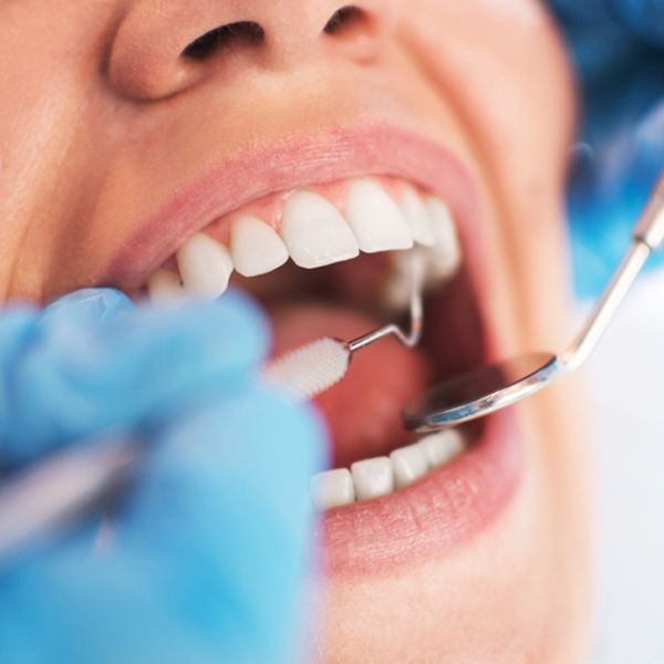 Dental Checkup — Paddington, QLD — Essential Dental Group