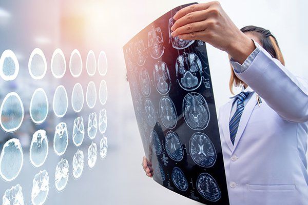 Brain Injury Causes — Doctor Holding MRI Film in Chicago, IL