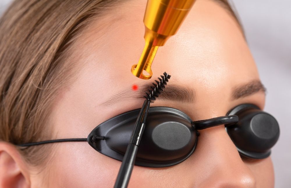 A Person Undergoing Eyebrow Laser Treatment — Hope Laser and Beauty Clinic In Taree, NSW