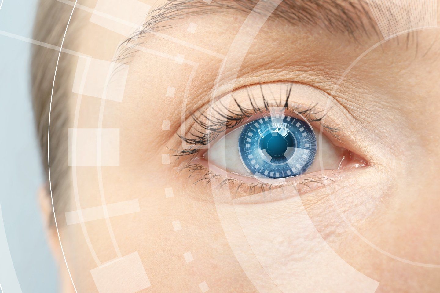 Il glaucoma è una malattia oculare cronica che danneggia progressivamente il nervo ottico, la strutt