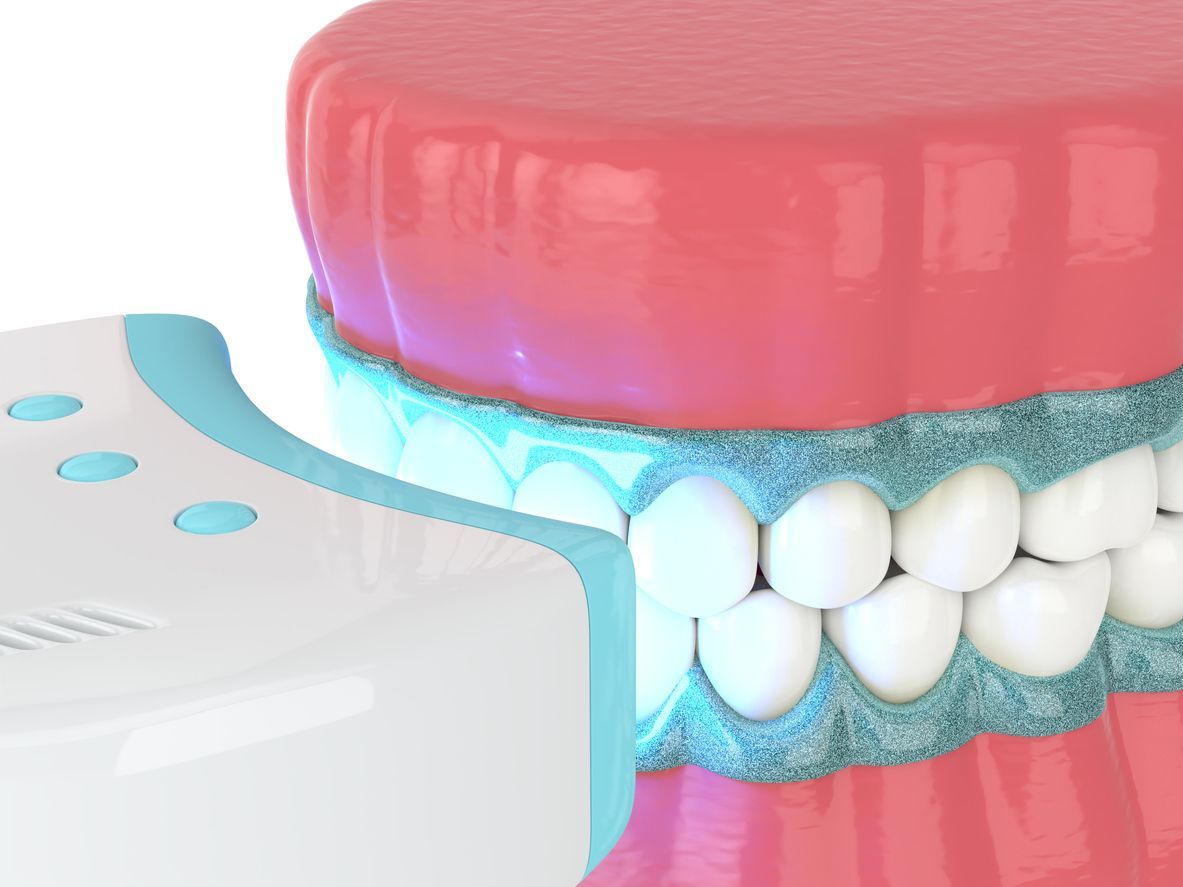 A close up of a model of a mouth with teeth and a toothbrush.