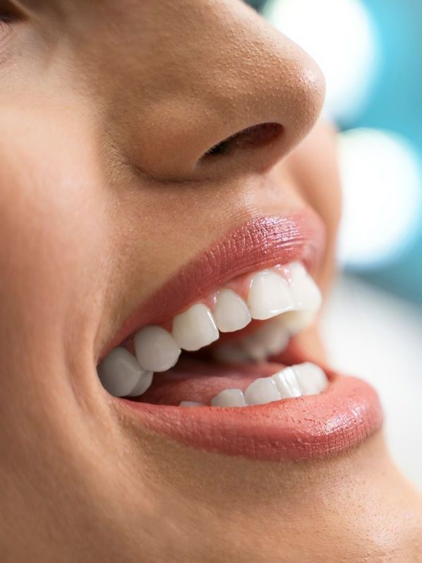 A close up of a woman 's mouth with white teeth.