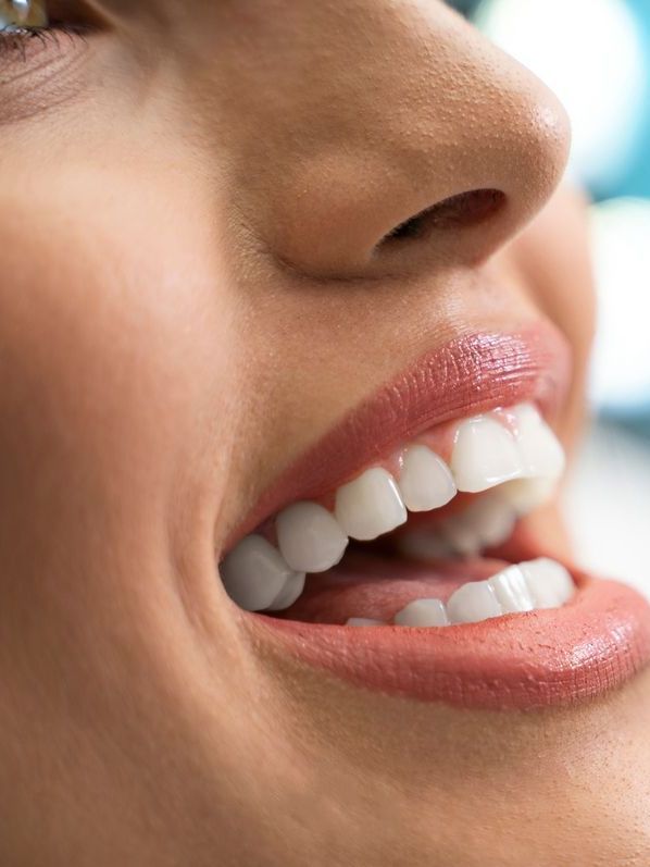 A close up of a woman 's mouth with her teeth showing.