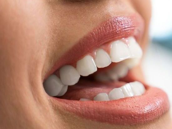 A close up of a woman 's teeth with her mouth open.