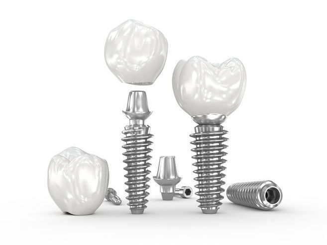 A 3d rendering of a dental implant with a crown and screws.