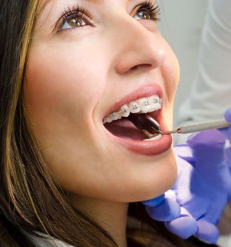 A woman with braces is getting her teeth examined by a dentist.