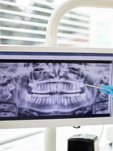 A dentist is looking at an x-ray of a person 's teeth on a computer screen.