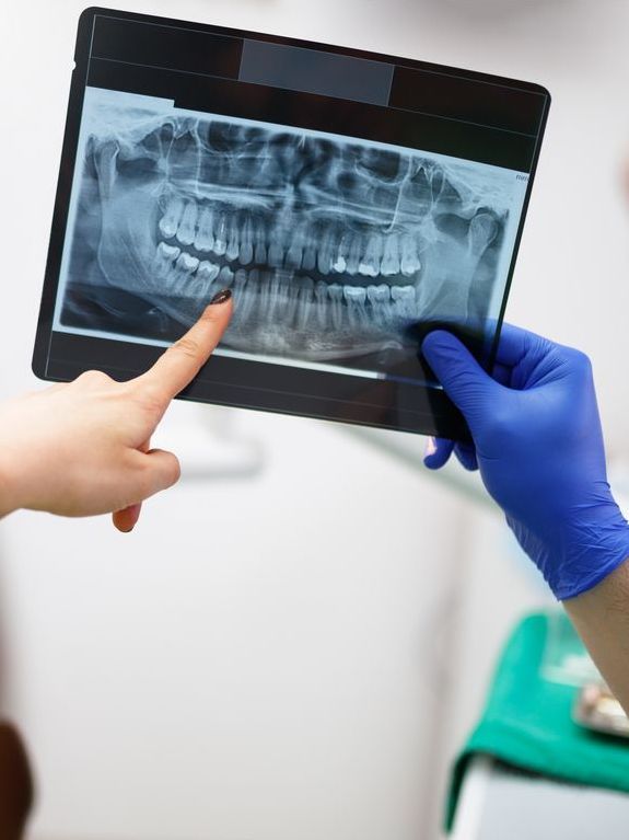 A person is pointing at an x-ray of a person 's teeth.