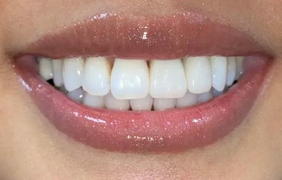 A close up of a woman 's mouth with white teeth and pink lips.