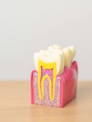 A model of a tooth is sitting on a wooden table.