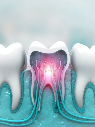 A close up of a tooth with a light coming out of it.