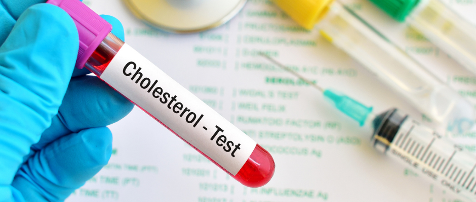 Cholesterol Testing | PrimeMed Cholesterol Testing | PrimeMed