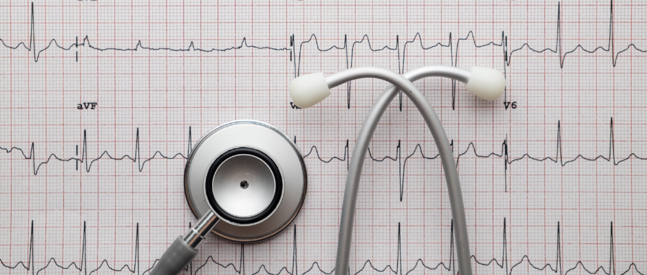 EKG | PrimeMed EKG | PrimeMed