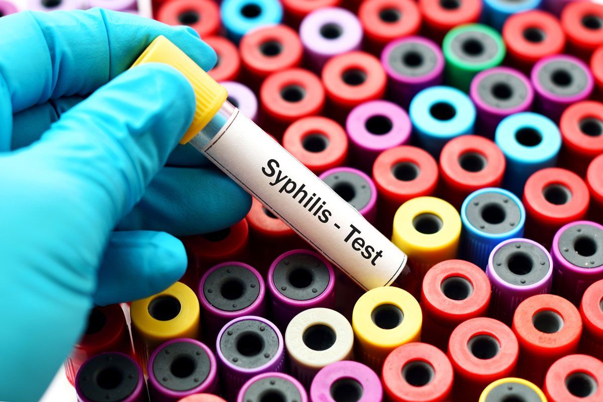 Cómo detectar la sífilis