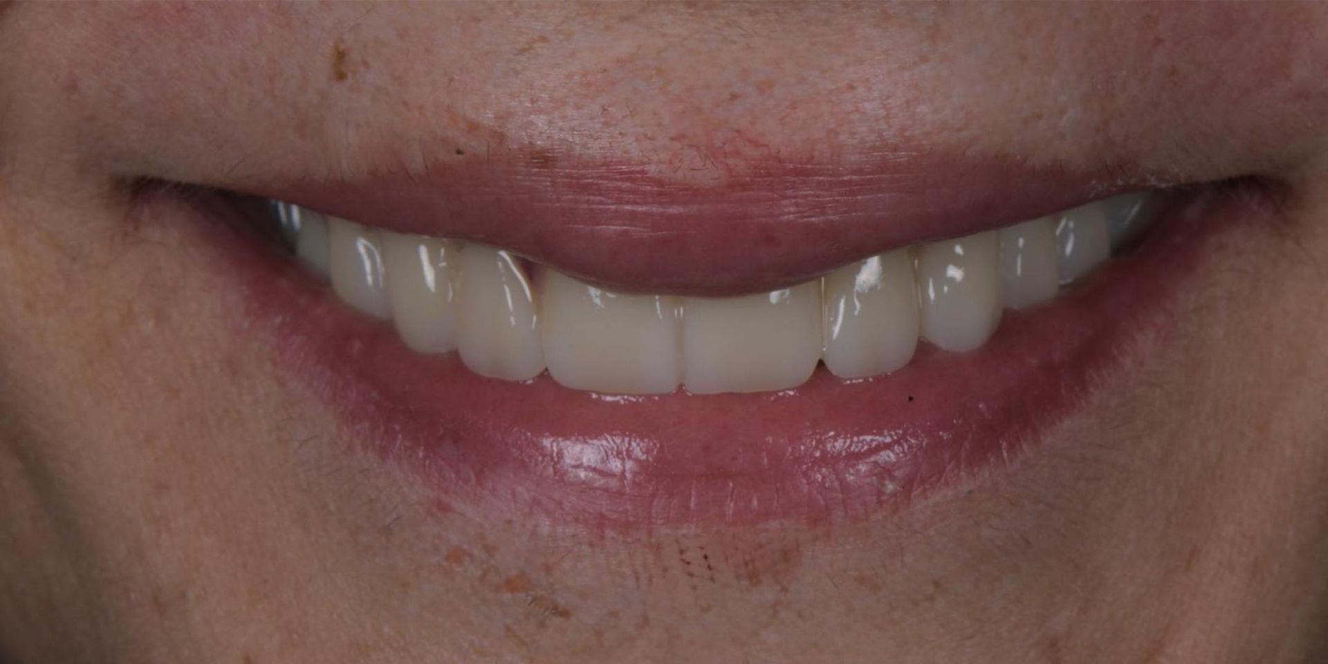 Primo piano di una bocca sorridente con denti bianchi e labbra rosa